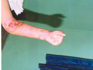 腾博会官网 - 诚信为本,专业效劳!