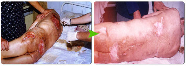 腾博会官网 - 诚信为本,专业效劳!