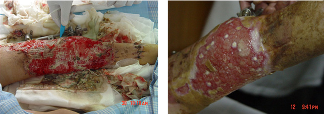 腾博会官网 - 诚信为本,专业效劳!