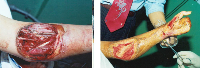 腾博会官网 - 诚信为本,专业效劳!