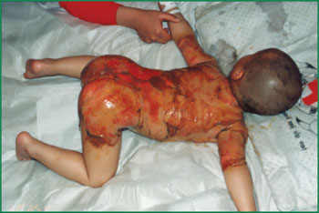 腾博会官网 - 诚信为本,专业效劳!