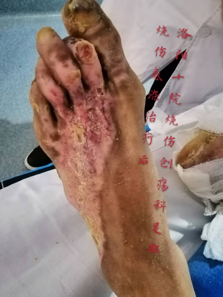 腾博会官网 - 诚信为本,专业效劳!