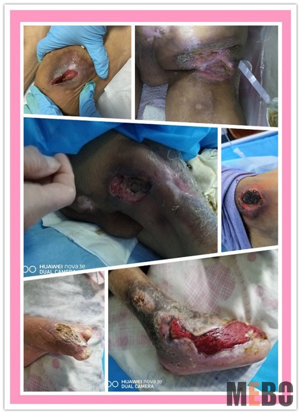 腾博会官网 - 诚信为本,专业效劳!