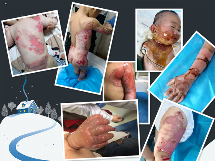 腾博会官网 - 诚信为本,专业效劳!