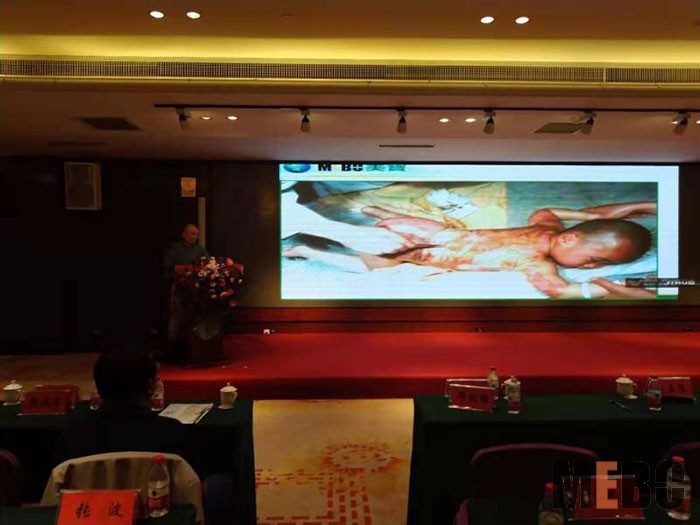 腾博会官网 - 诚信为本,专业效劳!