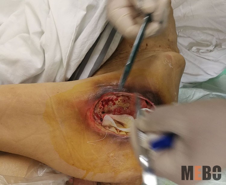 腾博会官网 - 诚信为本,专业效劳!