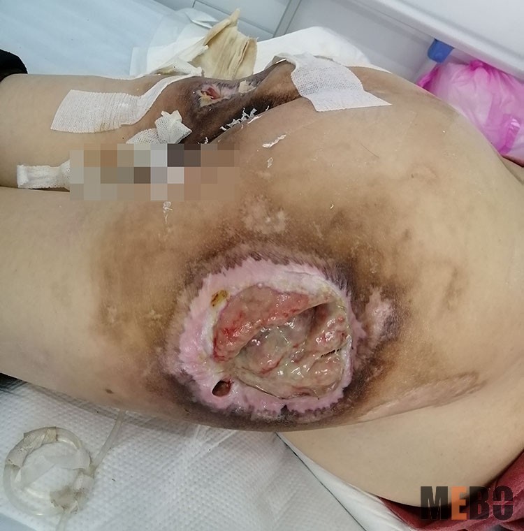 腾博会官网 - 诚信为本,专业效劳!