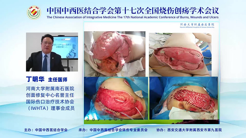 腾博会官网 - 诚信为本,专业效劳!