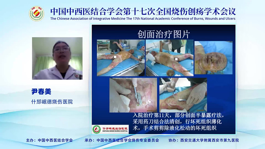 腾博会官网 - 诚信为本,专业效劳!