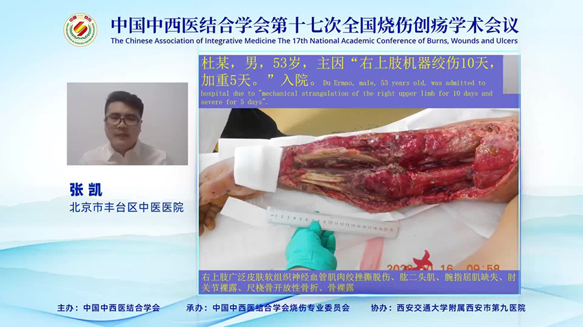 腾博会官网 - 诚信为本,专业效劳!