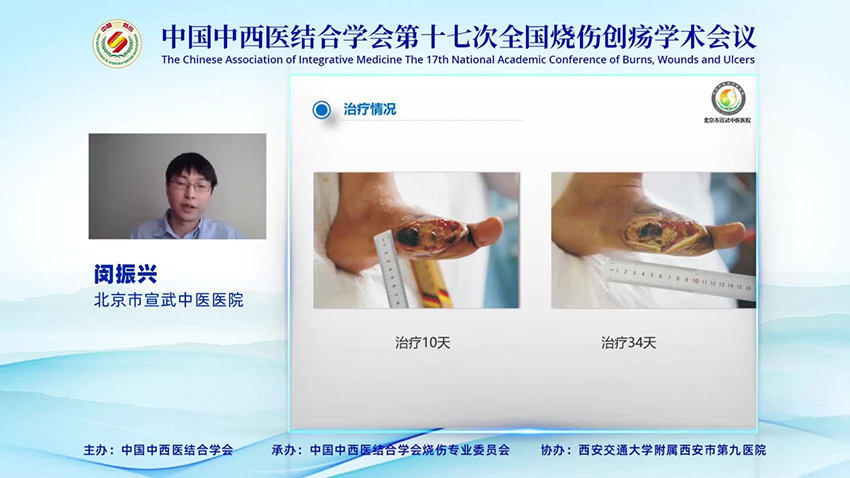 腾博会官网 - 诚信为本,专业效劳!