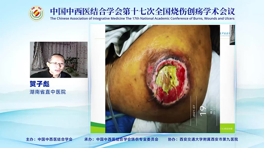 腾博会官网 - 诚信为本,专业效劳!