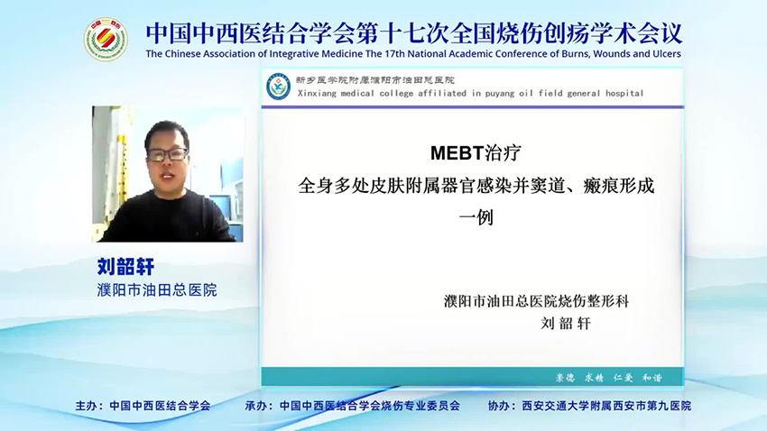 腾博会官网 - 诚信为本,专业效劳!