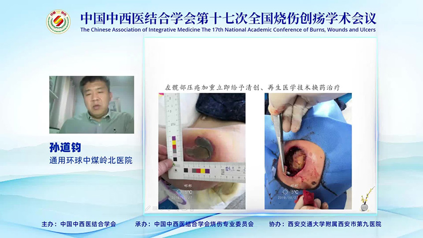 腾博会官网 - 诚信为本,专业效劳!