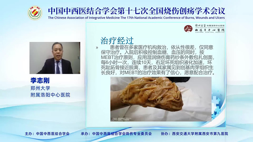 腾博会官网 - 诚信为本,专业效劳!