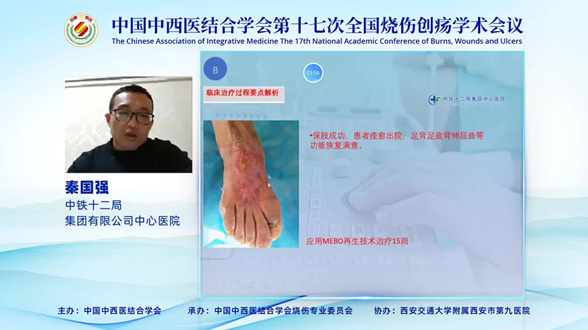 腾博会官网 - 诚信为本,专业效劳!