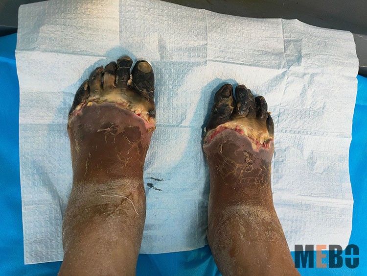 腾博会官网 - 诚信为本,专业效劳!