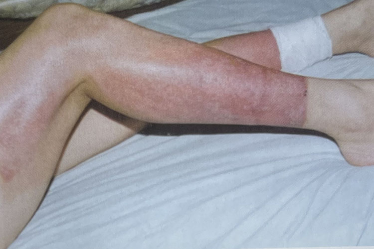 腾博会官网 - 诚信为本,专业效劳!