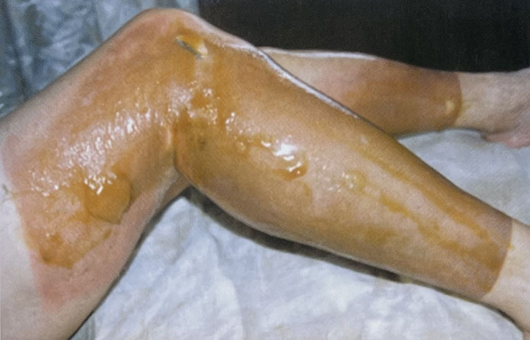 腾博会官网 - 诚信为本,专业效劳!