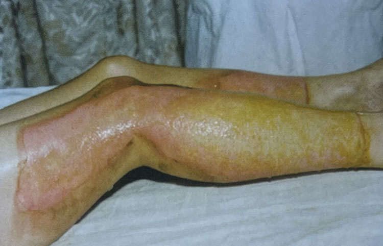 腾博会官网 - 诚信为本,专业效劳!