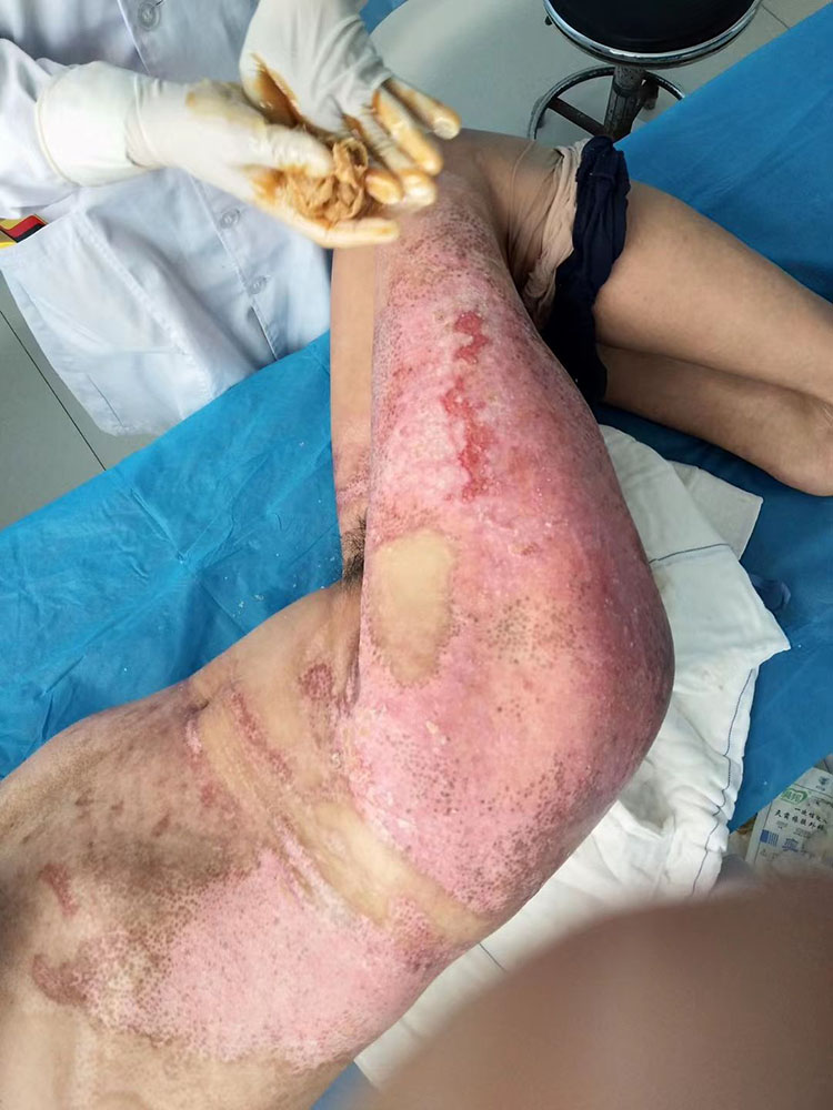 腾博会官网 - 诚信为本,专业效劳!