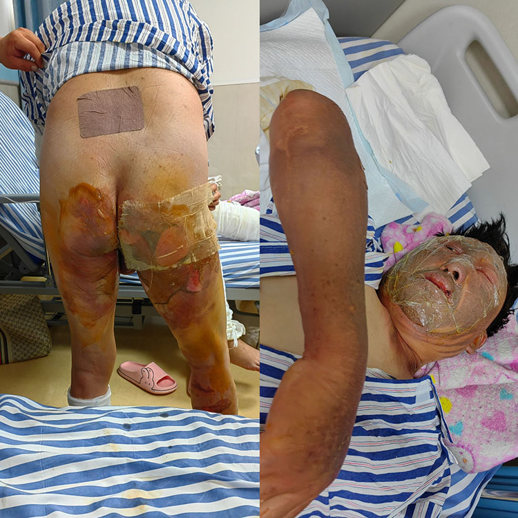 腾博会官网 - 诚信为本,专业效劳!