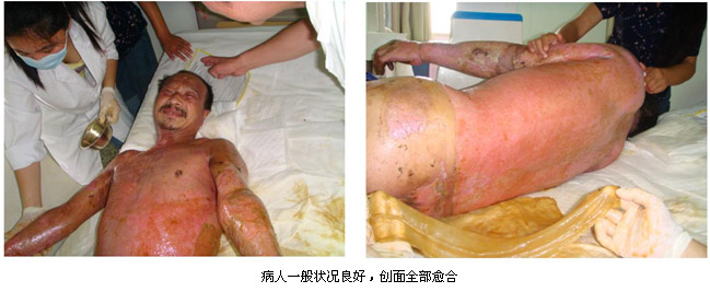 腾博会官网 - 诚信为本,专业效劳!