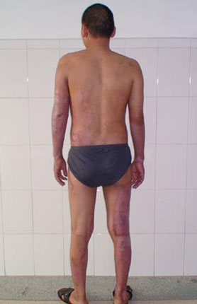 腾博会官网 - 诚信为本,专业效劳!