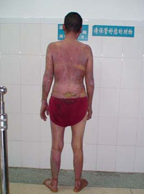 腾博会官网 - 诚信为本,专业效劳!