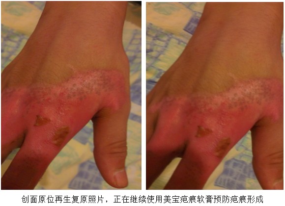 腾博会官网 - 诚信为本,专业效劳!