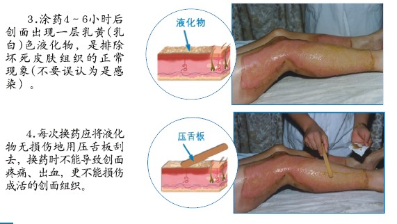 腾博会官网 - 诚信为本,专业效劳!