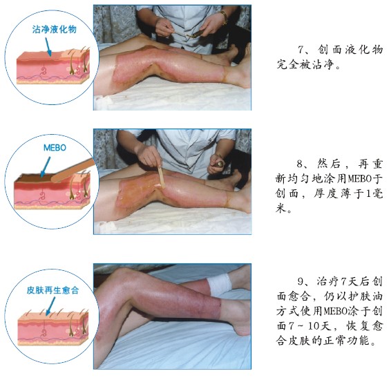 腾博会官网 - 诚信为本,专业效劳!