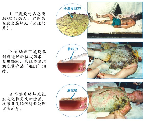 腾博会官网 - 诚信为本,专业效劳!