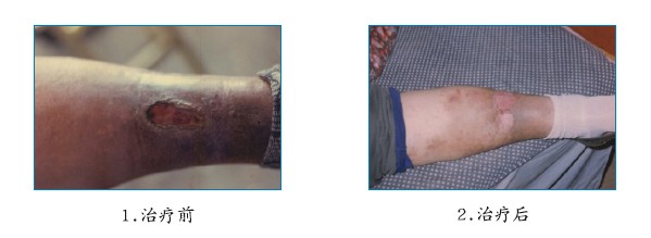 腾博会官网 - 诚信为本,专业效劳!