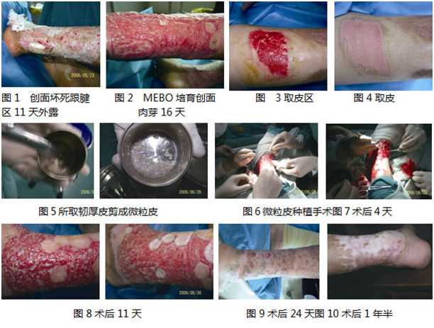腾博会官网 - 诚信为本,专业效劳!